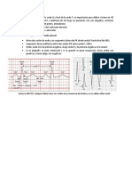 ekg 5