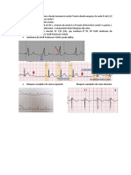 Ekg 8