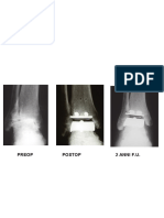 Dott. Buzzi Ortopedia - Piede 4 PDF