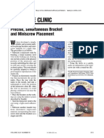 Technique Clinic: Precise, Simultaneous Bracket and Miniscrew Placement