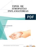 TIPOS  DE  ARTROPATÍAS INFLAMATORIAS 6 B (1)