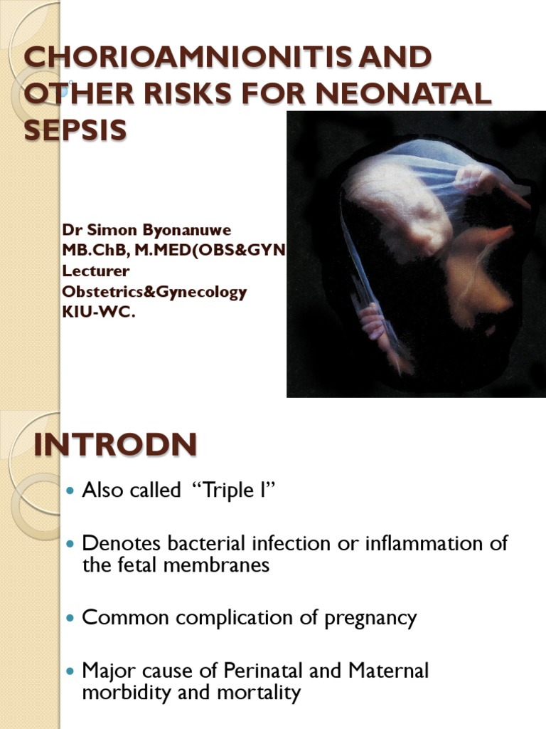 Chorioamnionitis and Neonatal Sepsis Risks | PDF | Preterm Birth ...