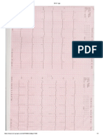 EKG-1.jpg (1)