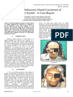 Recurrent Sebaceous Gland Carcinoma of Upper Eyelid - A Case Report