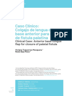 Art. 21 Caso Clínico Colgajo de lengua de base anterior para cierre de fístula palatina