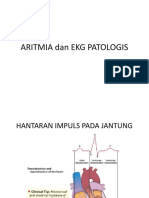 ARITMIA Dan EKG PATOLOGIS