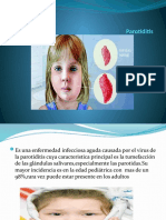 Exposicion de Pediatria Parotiditis