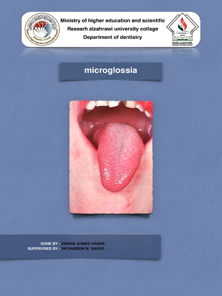 Microglossia Done BY Supervised BY PDF Tongue Animal Diseases