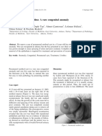 Parameatal Cyst of Urethra: A Rare Congenital Anomaly