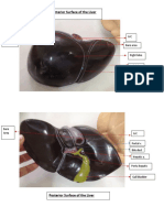 Models on Liver and some GI (2)