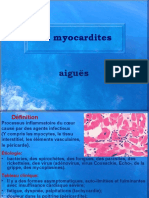 Myocardites et cardiomyopathies 