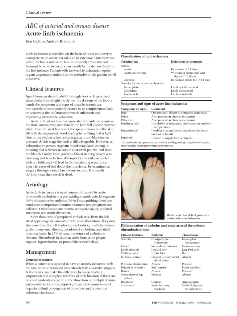 Acute Limb Ischemia PDF | PDF