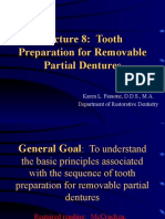 Lecture 8: Tooth Preparation For Removable Partial Dentures
