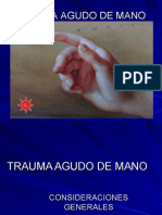 Trauma Agudo de Mano