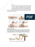 Reposisi Diskolasi Hip Joint