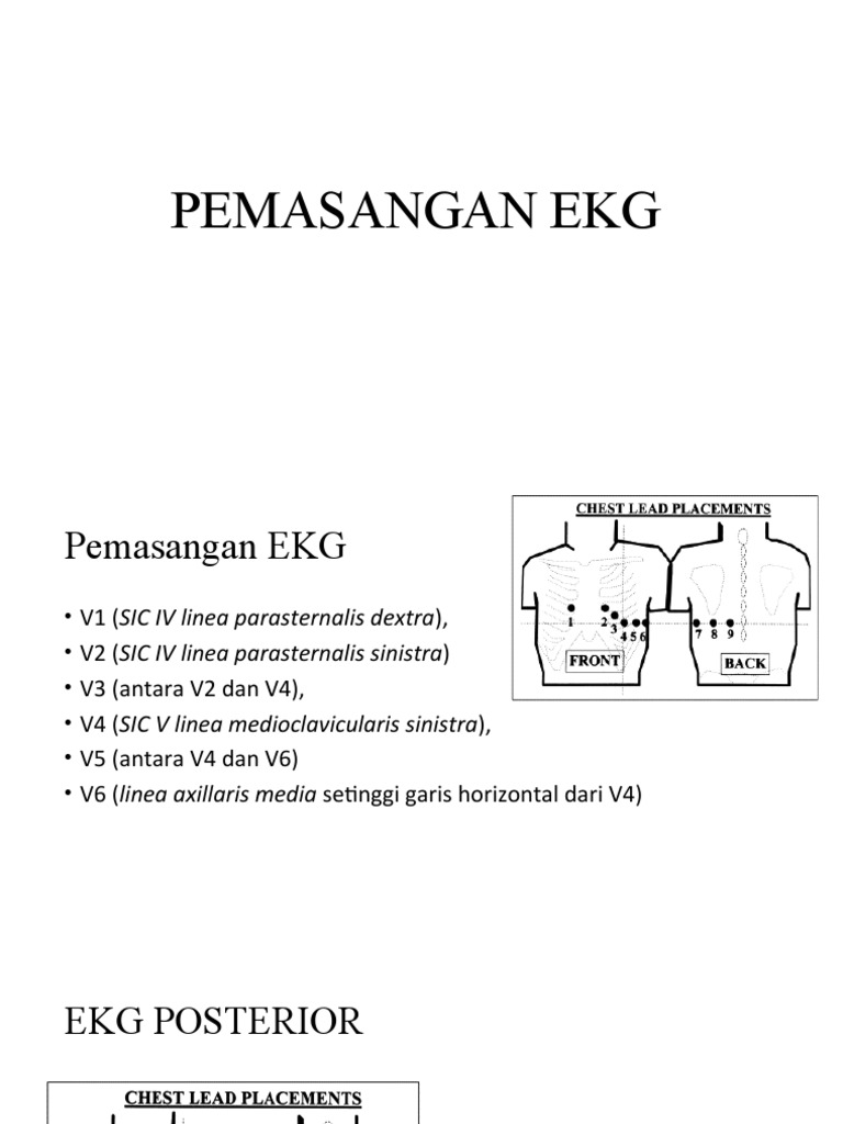 Pemasangan EKG Posterior dan Kanan | PDF