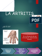 La Artritis