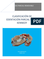 Clasificación de Edentación Parcial Según Kennedy