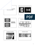 Alineacion y Oclusion de Los Dientes