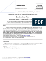 Numerical Analysis of Fractured Femur Bone With Prosthetic Bone Plates