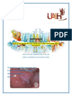Papel de los mastocitos en el liquen plano oral y reacciones orales liquenoides
