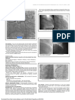 TCTAP C-025: Journaloftheamericancollegeofcardiology, Vol.67, No.16, Suppls, 2016