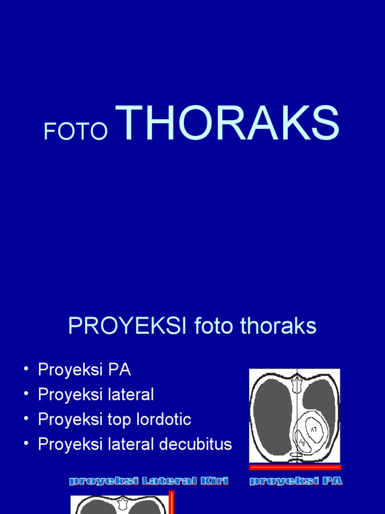 Panduan Membaca Foto Thoraks | PDF
