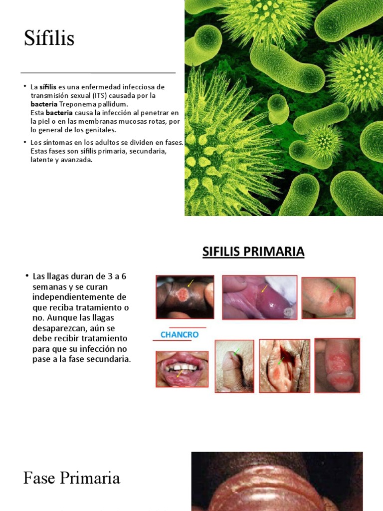 Sifilis y Gonorrea PDF Infección transmitida sexualmente