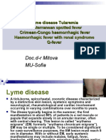 Lyme Disease TularemiaN