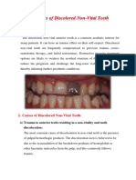A) Trauma To Anterior Teeth Resulting in A Non-Vitality and Tooth Discoloration