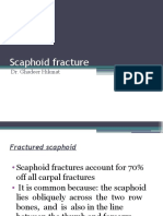 Scaohoid Fracture 4