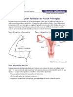 Northwestern Medicine Anticoncepcion Reversible de Accion Prolongada Larc