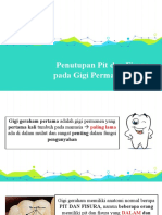 Penutupan Pit Dan Fisura Pada Gigi Permanen Anak