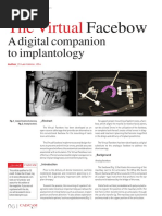 The Virtual Facebow A Digital Companion To Implantology