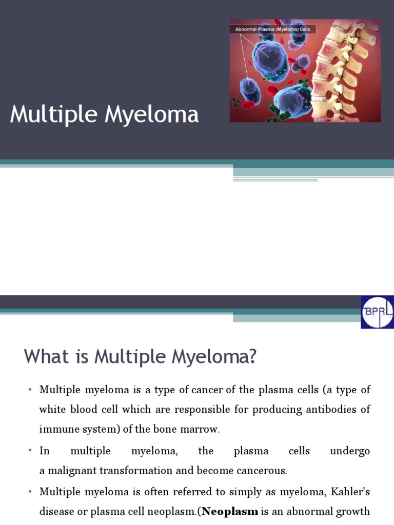 Overview of Multiple Myeloma | PDF | Multiple Myeloma | Lymphocyte