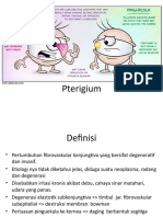 Pterigium