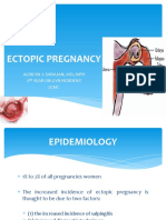 Ectopic Pregnancy: Aldilyn J. Sarajan, MD, MPH 2 Year Ob-Gyn Resident ZCMC