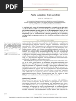 Acute Calculous Cholecystitis