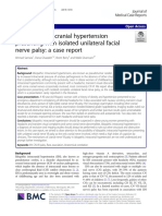 Idiopathic Intracranial Hypertension Presenting With Isolated Unilateral Facial Nerve Palsy: A Case Report