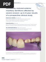 Mandibular Suction-Effective Denture - The Professional