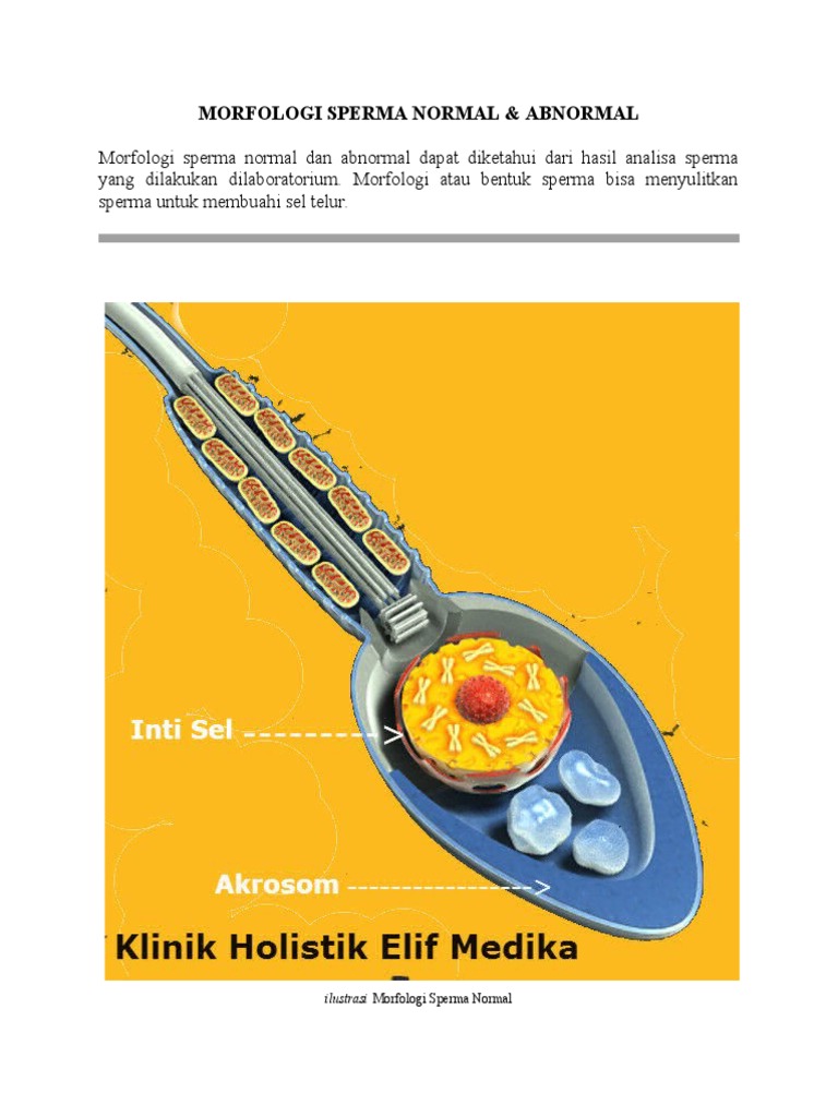 Xotin eri va dugonasining xoʻrozini soʻradi (foto)