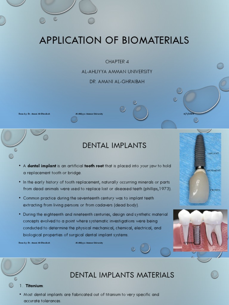 Biomaterial Lecture 20 PDF Dental Implant Poly(Methyl Methacrylate)