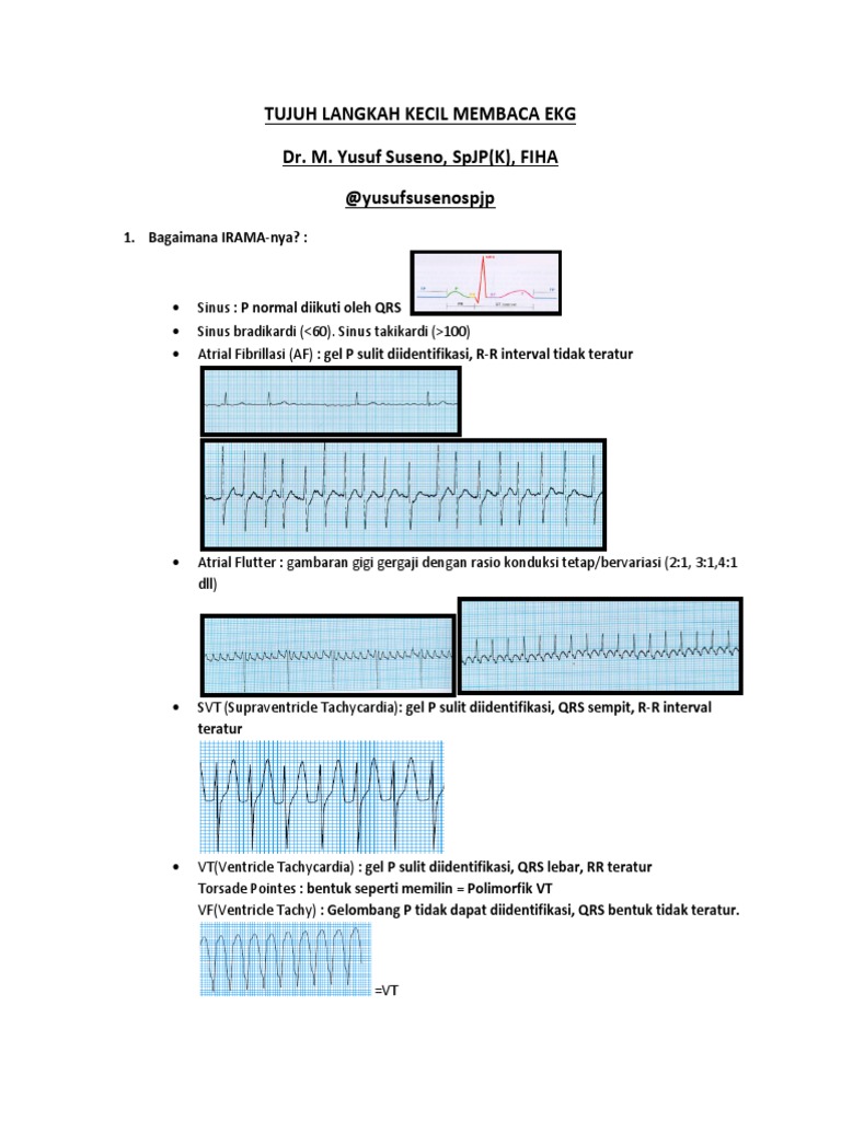 Ekg PDF | PDF | Seni