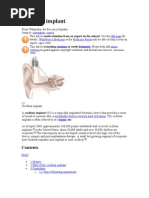 Download Cochlear Implant by Florin Niculai SN47091799 doc pdf