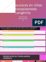 Toxoplasmosis Ocular - Karla Bungacho