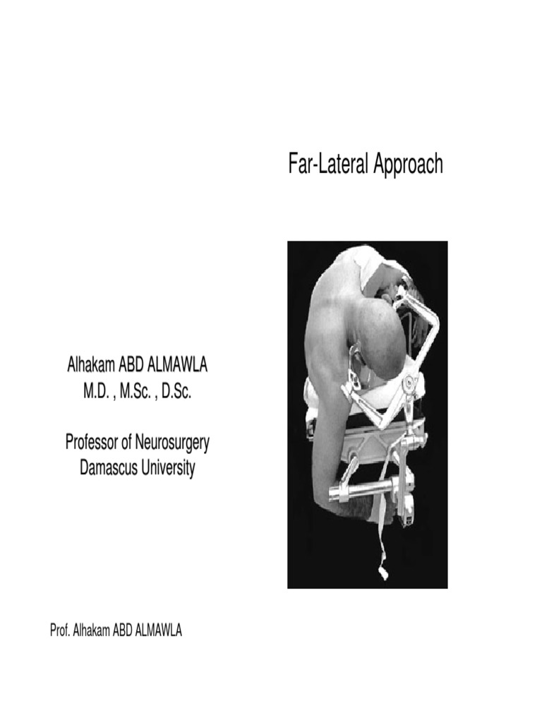 Far-Lateral Approach in Neurosurgery | PDF | Vertebra | Neck