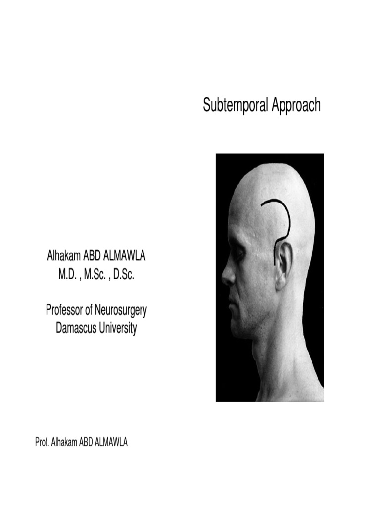 Subtemporal Approach in Neurosurgery | PDF