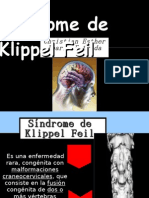 Sindrome de Klippel