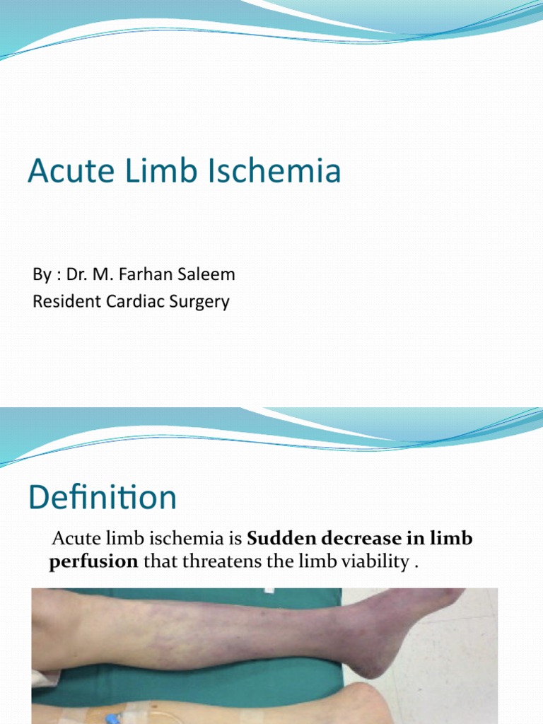 Understanding Acute Limb Ischemia | PDF | Ischemia | Angiology