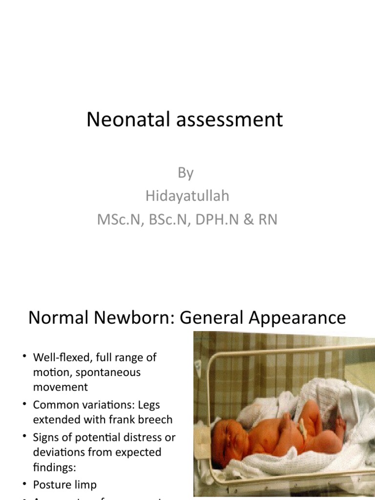 Assessment of Neoborn Final | PDF | Human Nose | Infants